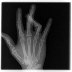 minor setbacks. . .(aka the clutch as first aid kit)